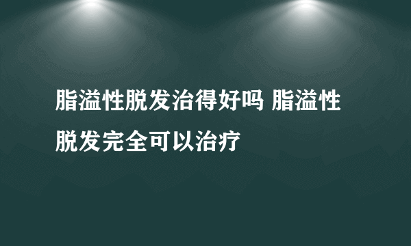 脂溢性脱发治得好吗 脂溢性脱发完全可以治疗