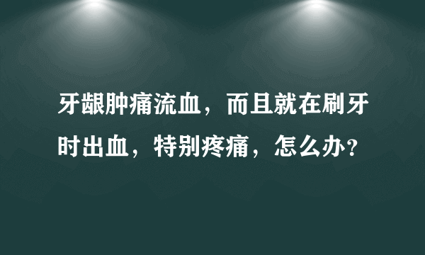 牙龈肿痛流血，而且就在刷牙时出血，特别疼痛，怎么办？