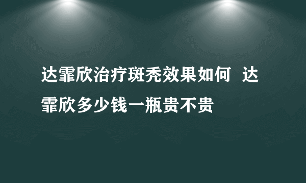 达霏欣治疗斑秃效果如何  达霏欣多少钱一瓶贵不贵