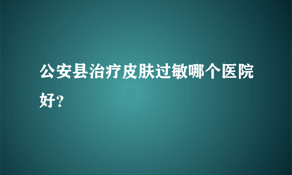 公安县治疗皮肤过敏哪个医院好？