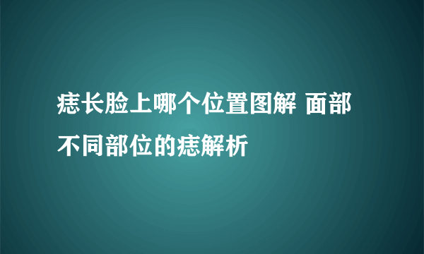 痣长脸上哪个位置图解 面部不同部位的痣解析