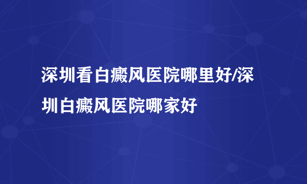 深圳看白癜风医院哪里好/深圳白癜风医院哪家好