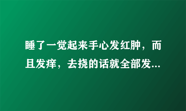 睡了一觉起来手心发红肿，而且发痒，去挠的话就全部发肿而且手心发烧是怎么回事