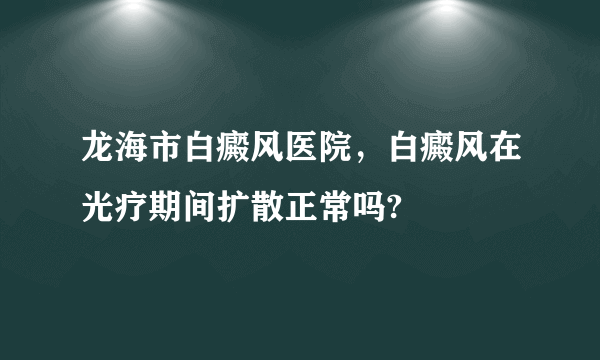 龙海市白癜风医院，白癜风在光疗期间扩散正常吗?