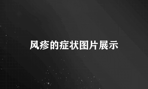 风疹的症状图片展示