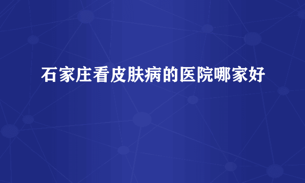 石家庄看皮肤病的医院哪家好