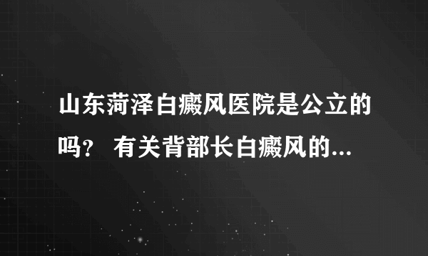 山东菏泽白癜风医院是公立的吗？ 有关背部长白癜风的原因是什么？