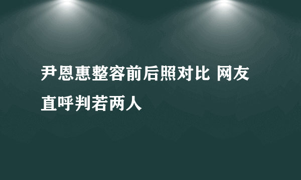 尹恩惠整容前后照对比 网友直呼判若两人