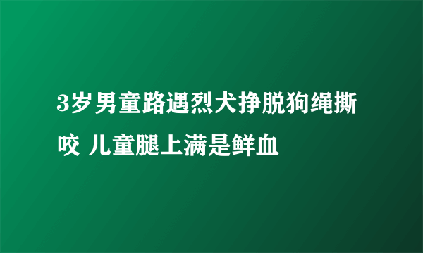 3岁男童路遇烈犬挣脱狗绳撕咬 儿童腿上满是鲜血