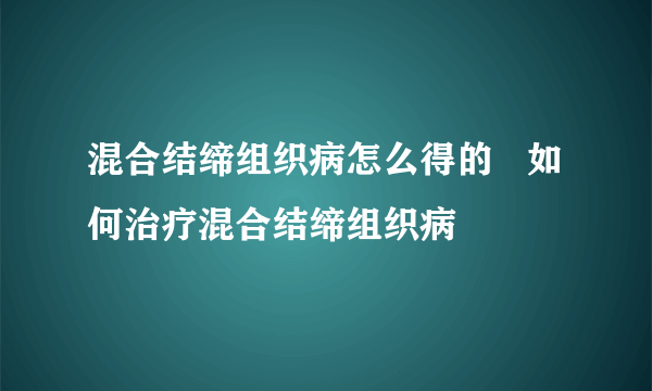 混合结缔组织病怎么得的   如何治疗混合结缔组织病