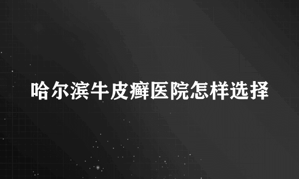 哈尔滨牛皮癣医院怎样选择