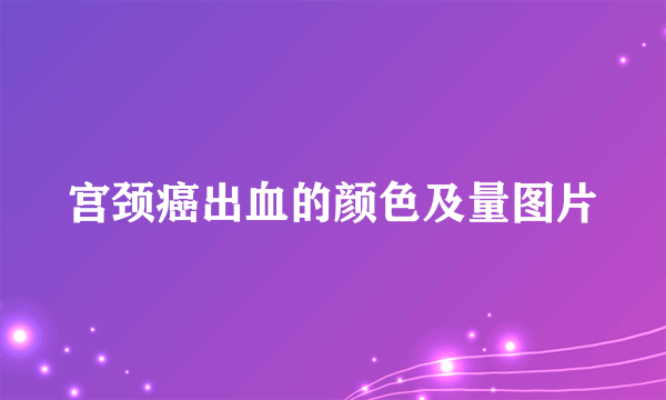 宫颈癌出血的颜色及量图片