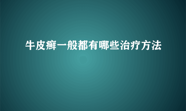 牛皮癣一般都有哪些治疗方法