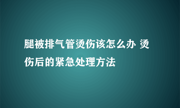 腿被排气管烫伤该怎么办 烫伤后的紧急处理方法