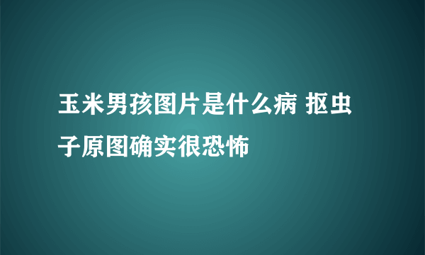 玉米男孩图片是什么病 抠虫子原图确实很恐怖