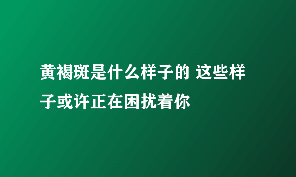 黄褐斑是什么样子的 这些样子或许正在困扰着你