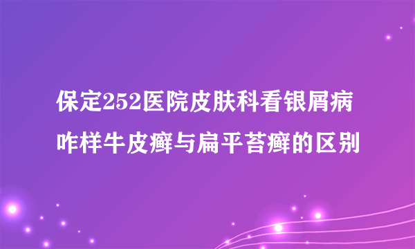 保定252医院皮肤科看银屑病咋样牛皮癣与扁平苔癣的区别