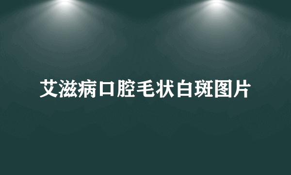 艾滋病口腔毛状白斑图片