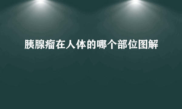 胰腺瘤在人体的哪个部位图解