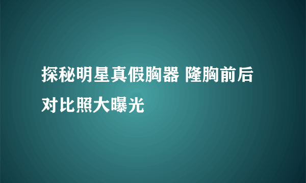 探秘明星真假胸器 隆胸前后对比照大曝光