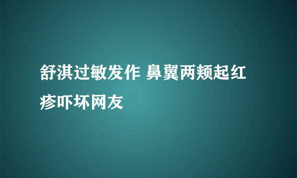 舒淇过敏发作 鼻翼两颊起红疹吓坏网友