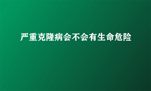 严重克隆病会不会有生命危险