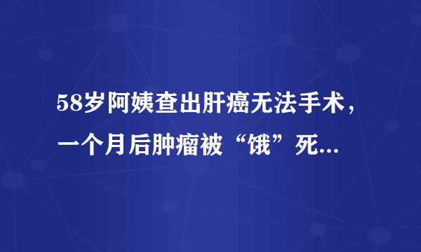 58岁阿姨查出肝癌无法手术，一个月后肿瘤被“饿”死，发生了什么