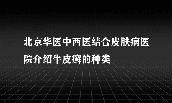 北京华医中西医结合皮肤病医院介绍牛皮癣的种类